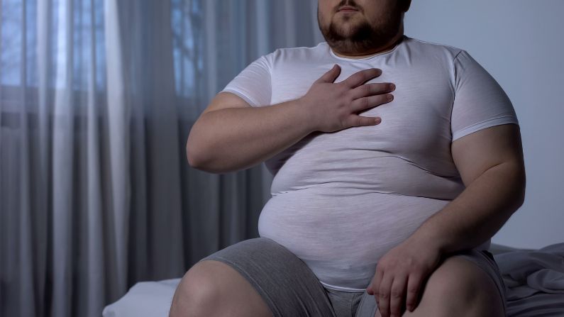 Kesan Obesiti risiko stroke